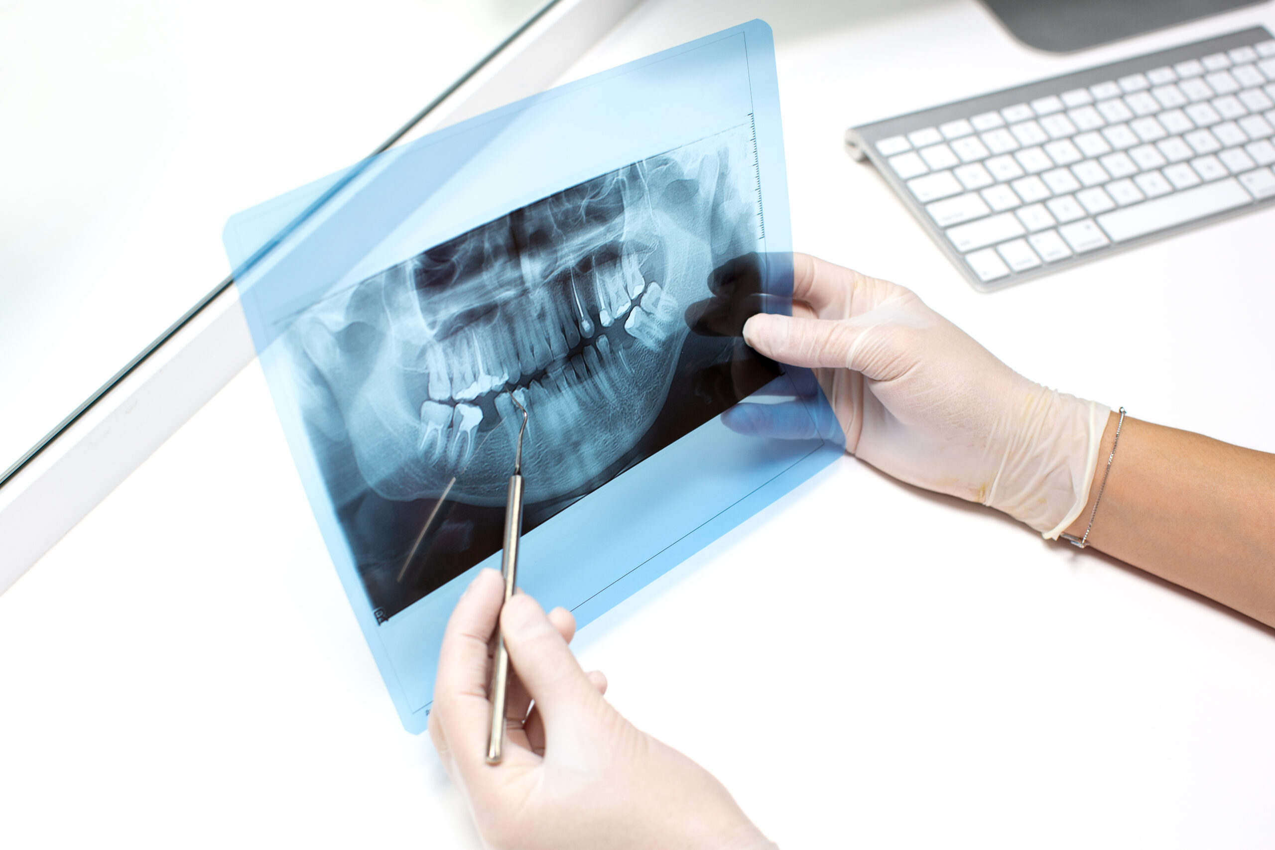 Read more about the article Dental Radiology